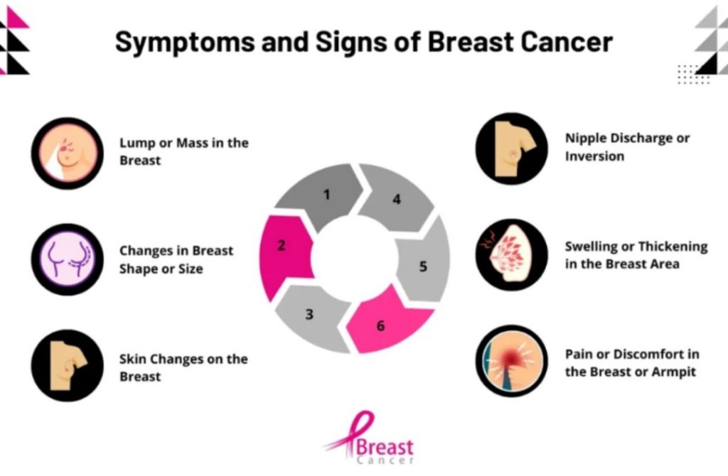 sign and symptoms of cancer of the breast